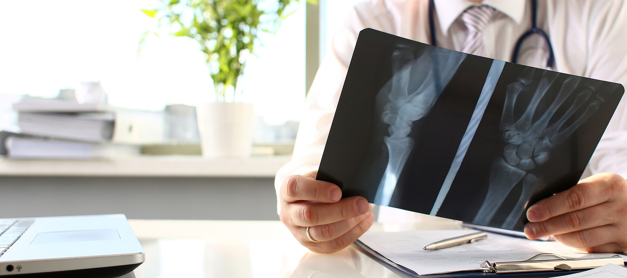 A Keck Medicine hand specialist holds X-rays of a joint and hand injury at a table with pen and paper in front of a window