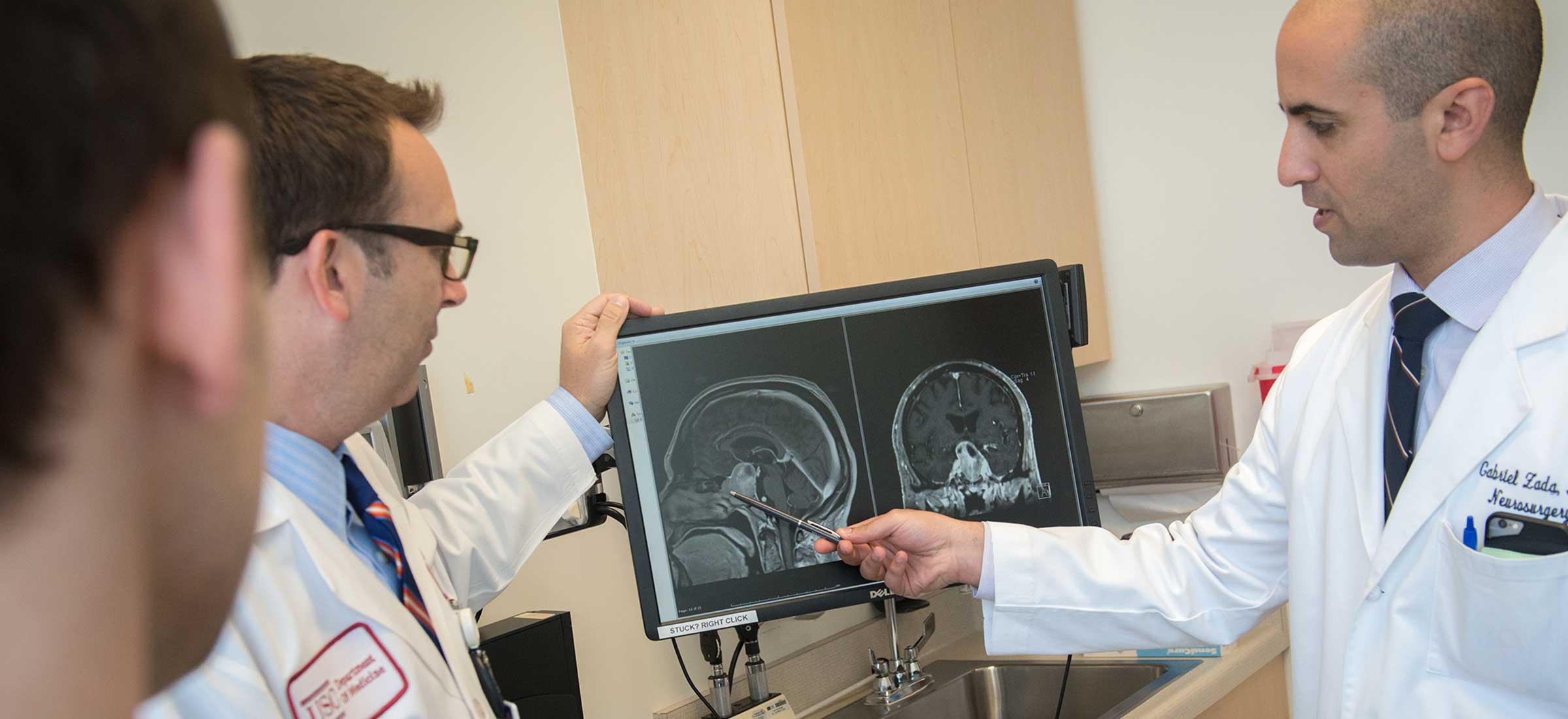 Dr. Gabriel Zada points to a scan of a patient's brain and discusses it with other members of the USC Brain Tumor Center team.