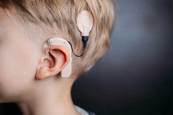 A picture of a cochlear implant on a blonde child's ear.