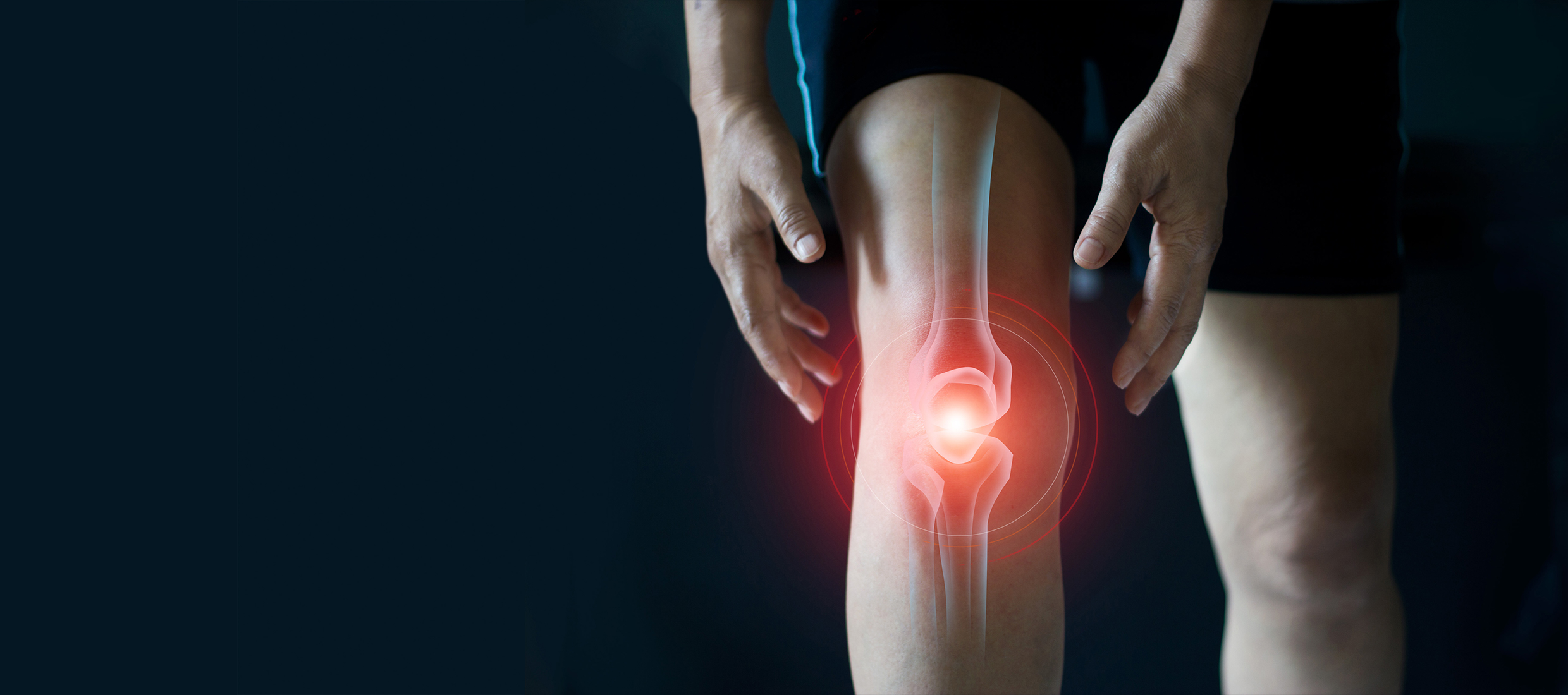 A man in black shorts holds his right knee that shows a rendering of an inflamed meniscus tear