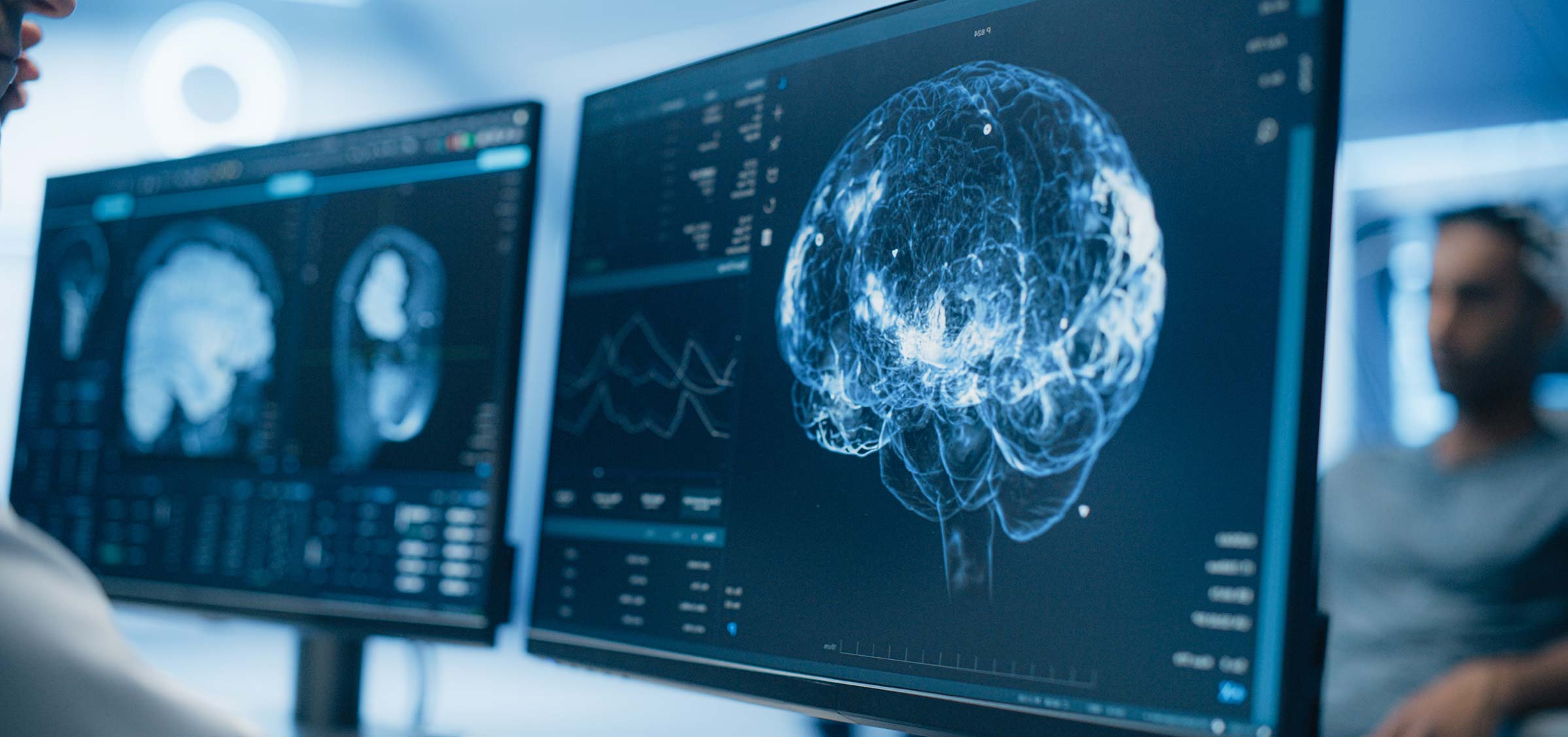 A healthcare professional views a high-resolution 3D digital rendering of a human brain on a computer monitor, next to a second screen displaying detailed neurovascular scan data and medical charts.