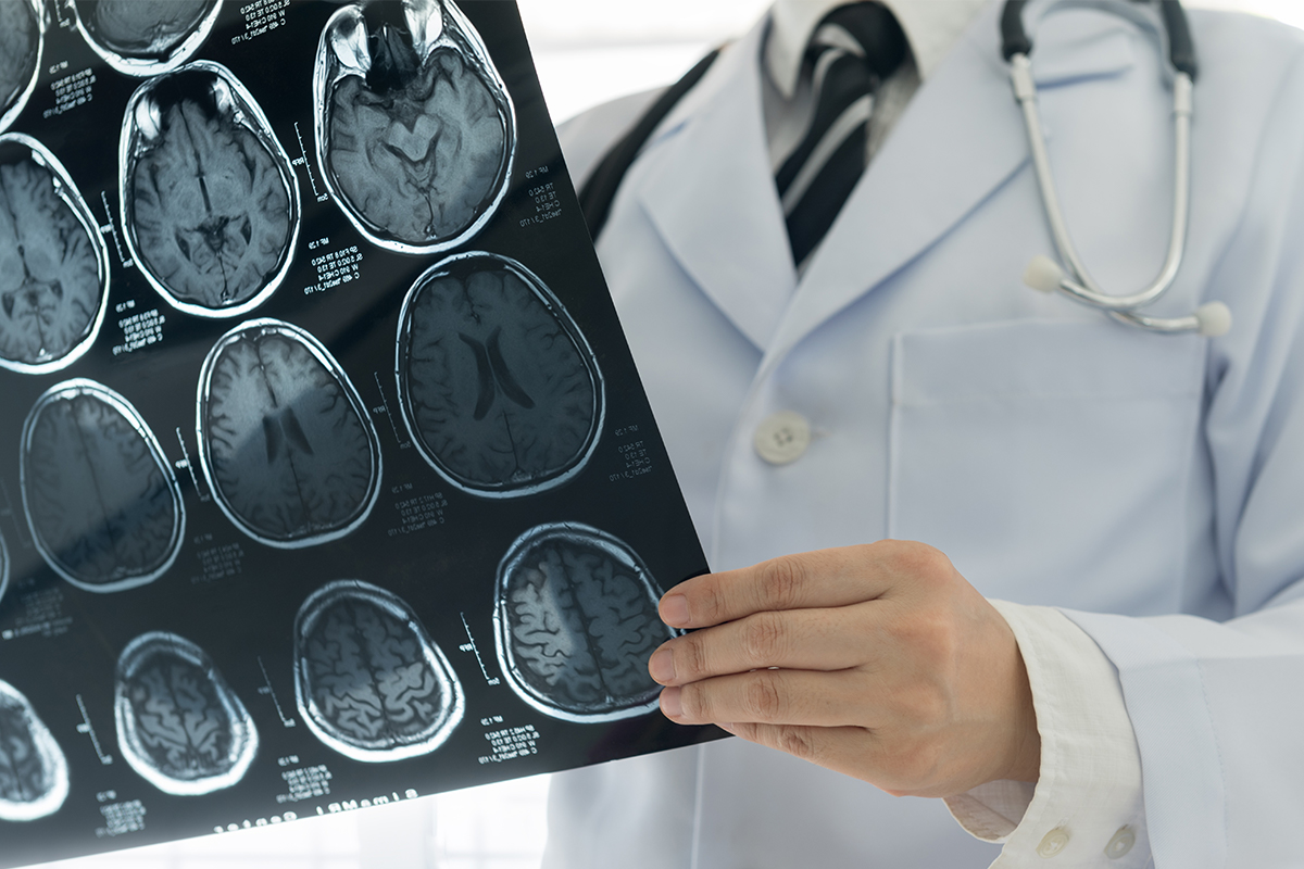 A Keck Medicine of USC doctor holds a panel of X-rays of human brains and the pituitary gland