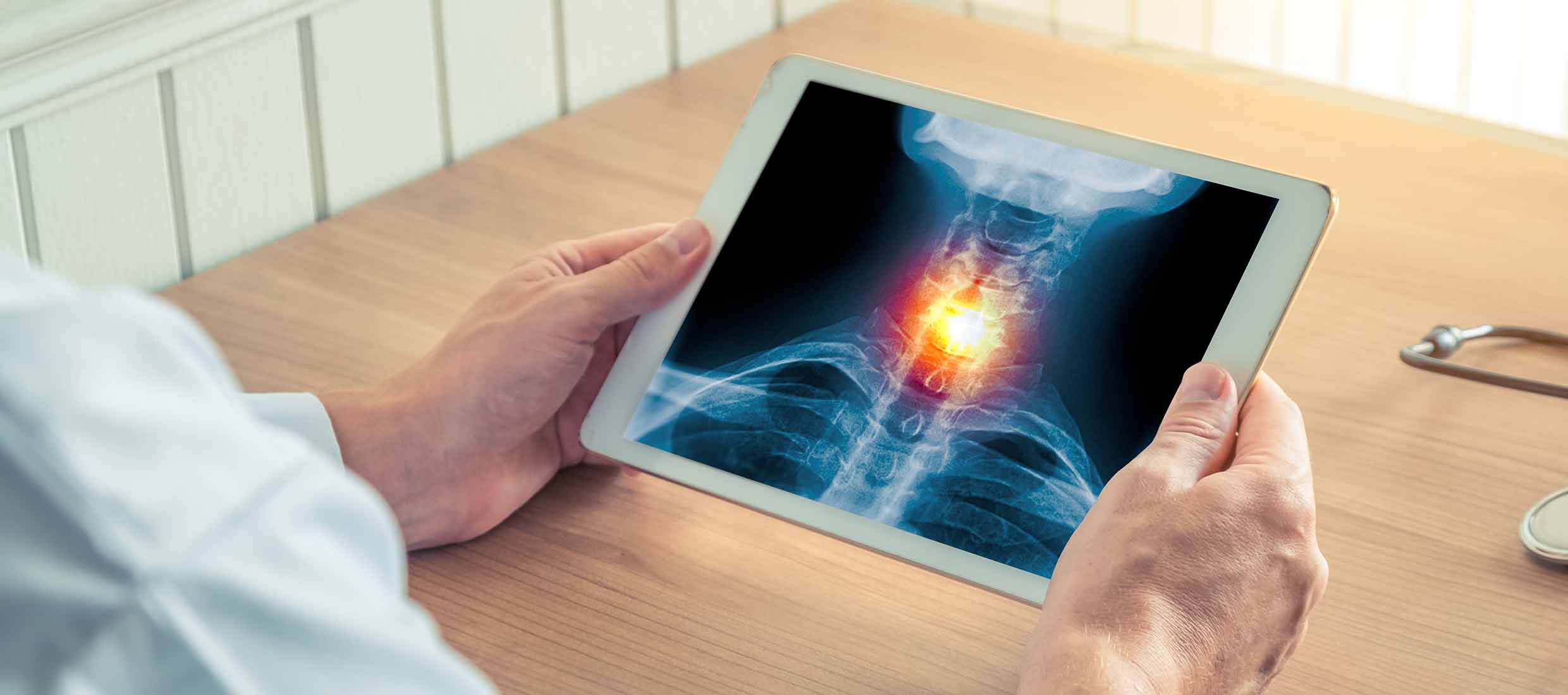 Doctor holding an x-ray of a throat in a medical office