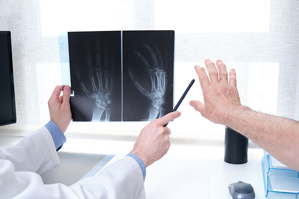 Doctor examining an X-ray of a patient's hands