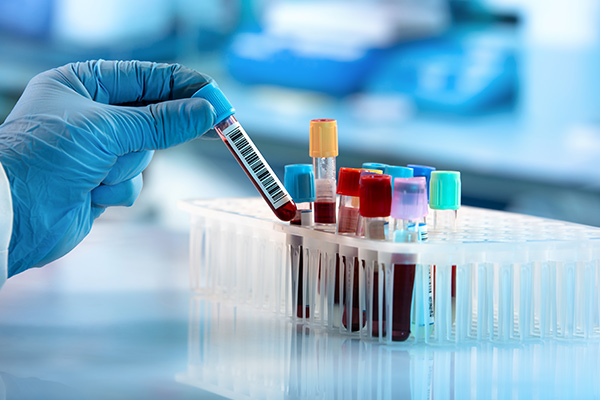 A gloved hand grabs a vial of blood from a rack.