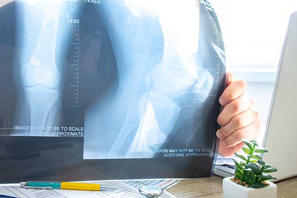 X-ray of a knee being reviewed by a medical professional