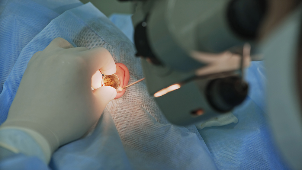 Doctor examining patient's ear during ear surgery.